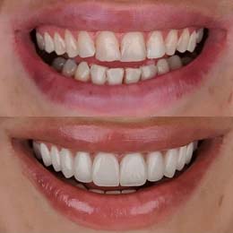 Cosmetic Dentistry 1