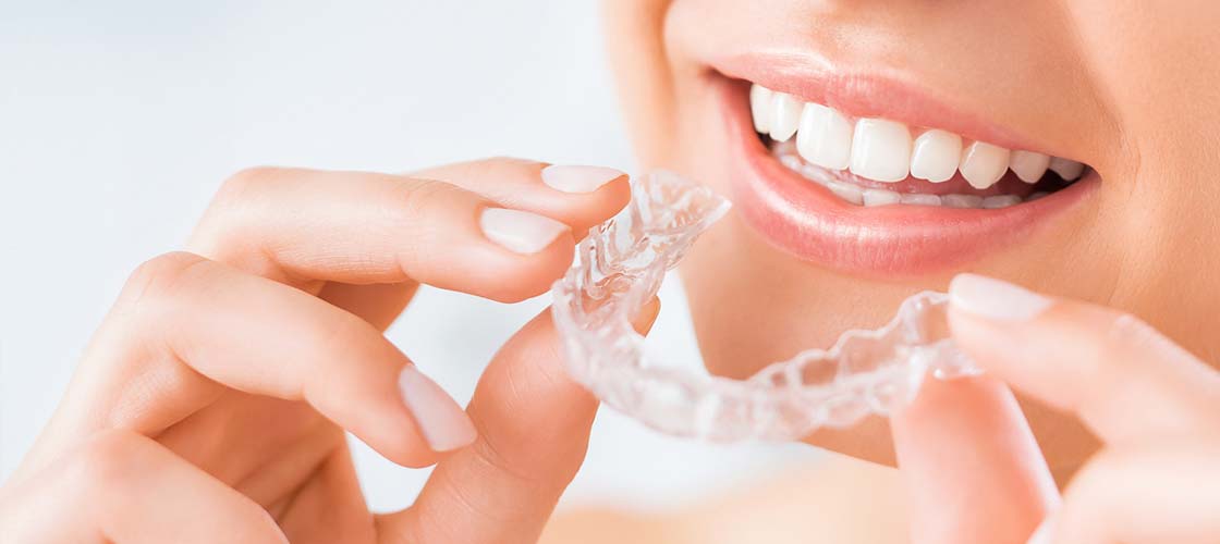 Short-Term Orthodontics: Achieve a Beautiful Smile Quickly